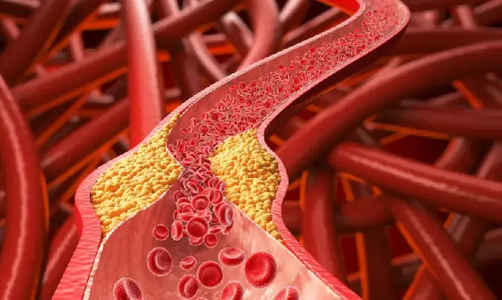 Alimento comum pode ajudar a derrubar o colesterol “ruim”